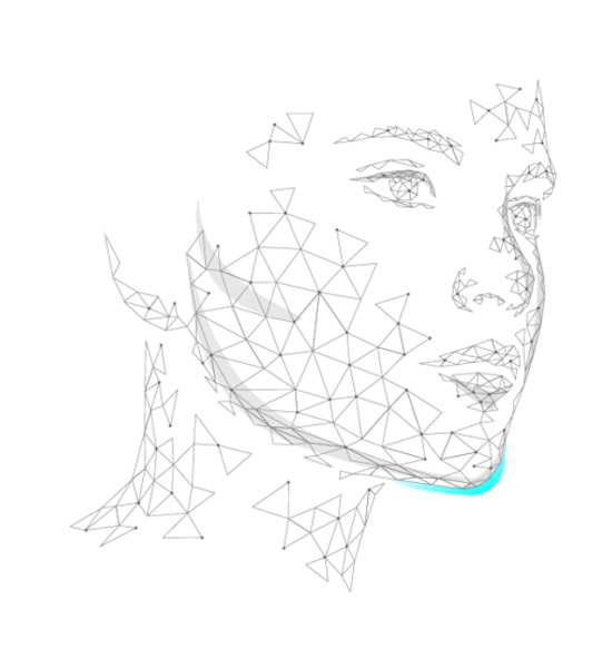 Forehead Lift